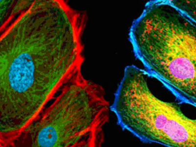 無自發(fā)熒光，成像效果佳，可用于熒光顯微實驗、激光共聚焦顯微實驗、熒光原位雜交（FISH）和相差顯微實驗等